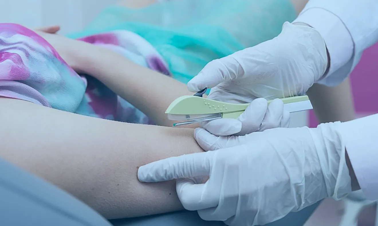 IMPLANON: NOVO MÉTODO CONTRACEPTIVO ESTÁ DISPONÍVEL NAS UNIDADES BÁSICAS DE SAÚDE DO DF